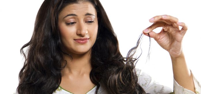 10 Home Remedies To Treat Dandruff At Home